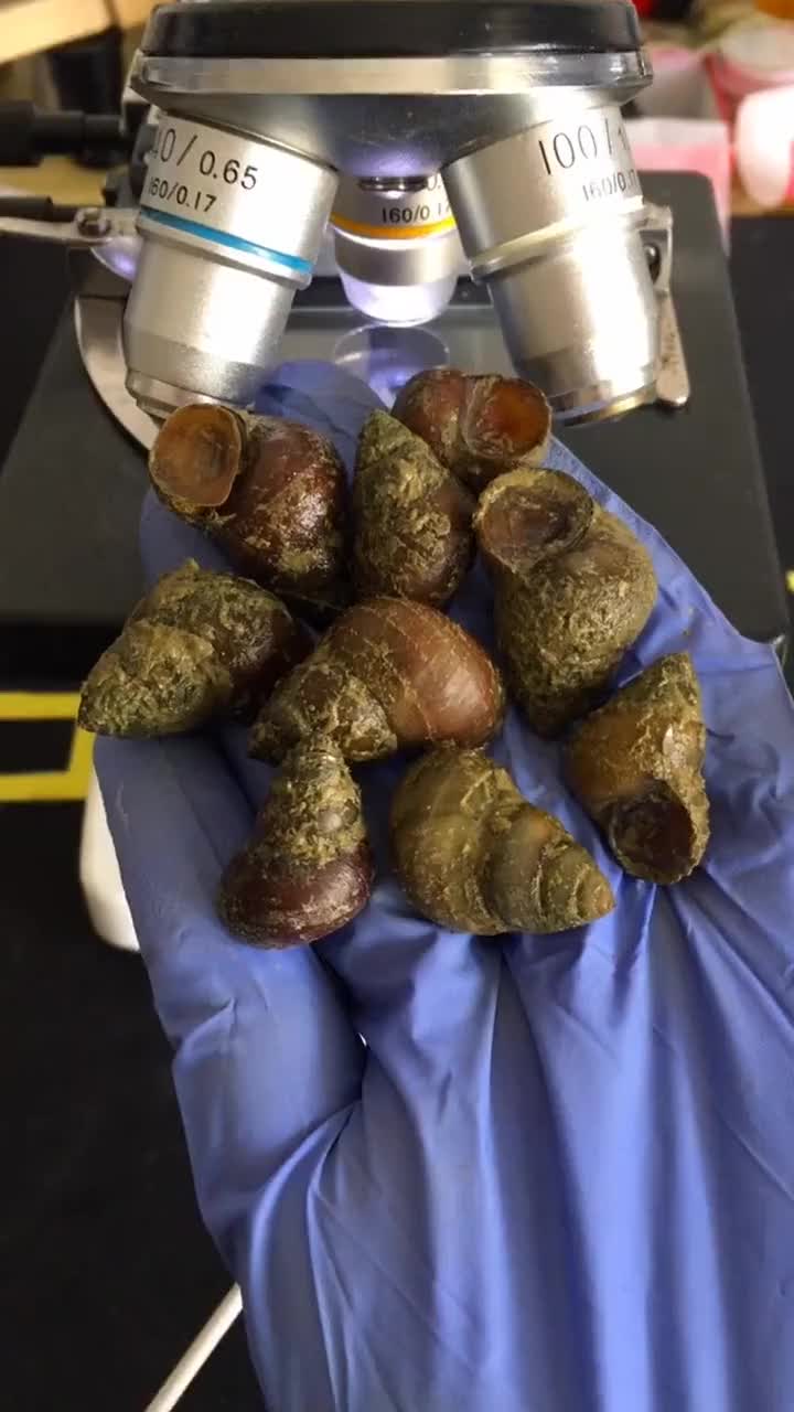 田螺在显微镜下放大200倍是什么样?结果让网友大吃一惊