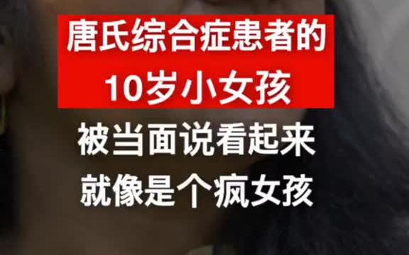 [图]【国际采访】患有唐氏综合症的10岁小女孩被人当面说：看起来就像个疯子。妈妈是何等的心疼她？