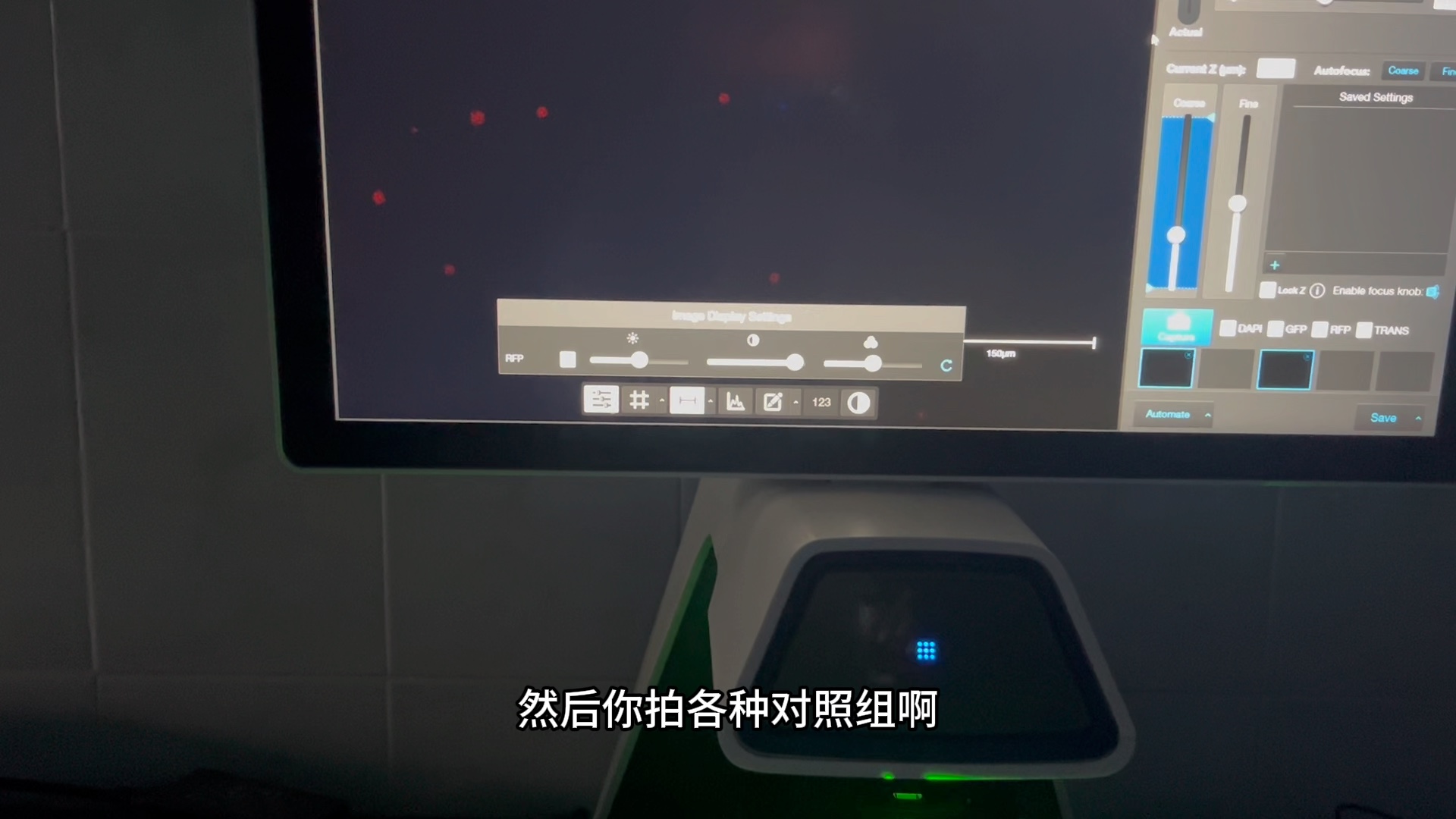 hoechst 33342/pi荧光拍照