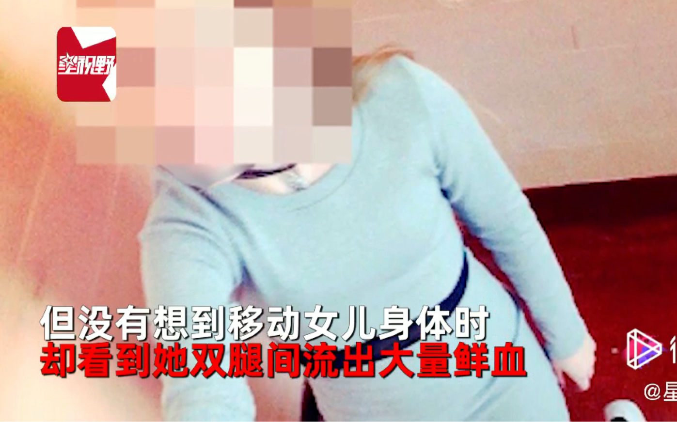 [图]14岁少女半夜疼痛呻吟 妈妈开门一看瞬间吓傻