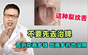 Tải video: 这种裂纹舌，不要先去治脾，否则花再多钱，吃再多药也没用！