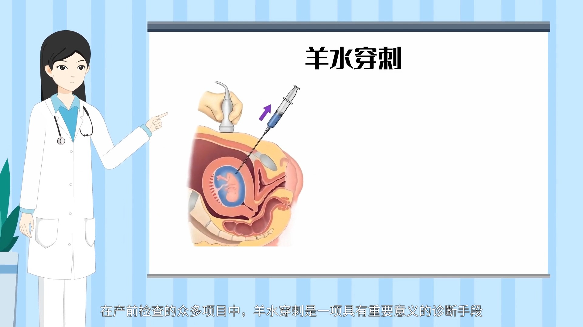 【科普动漫】羊水穿刺在产前诊断中的作用