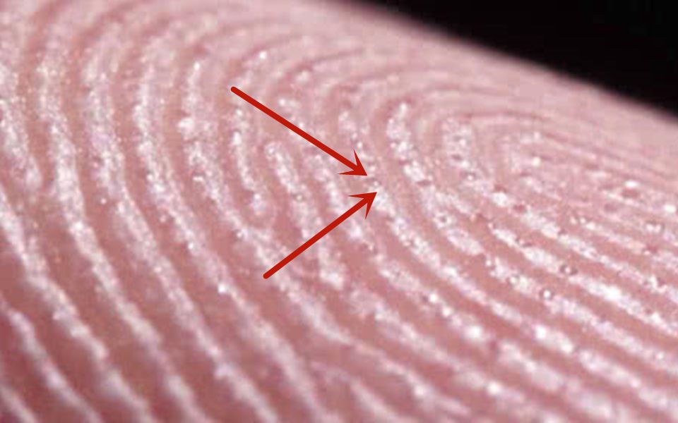 手掌怎么出汗?显微镜放大后成奇观,网友:为啥不一起冒出来?