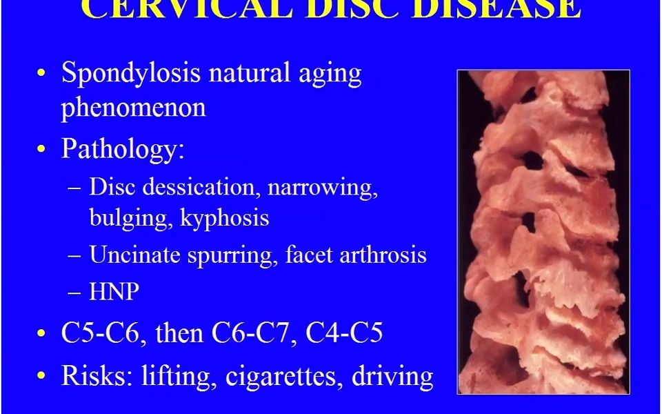 [图]Miller's Orthopaedic Lectures Spine1骨科学课程