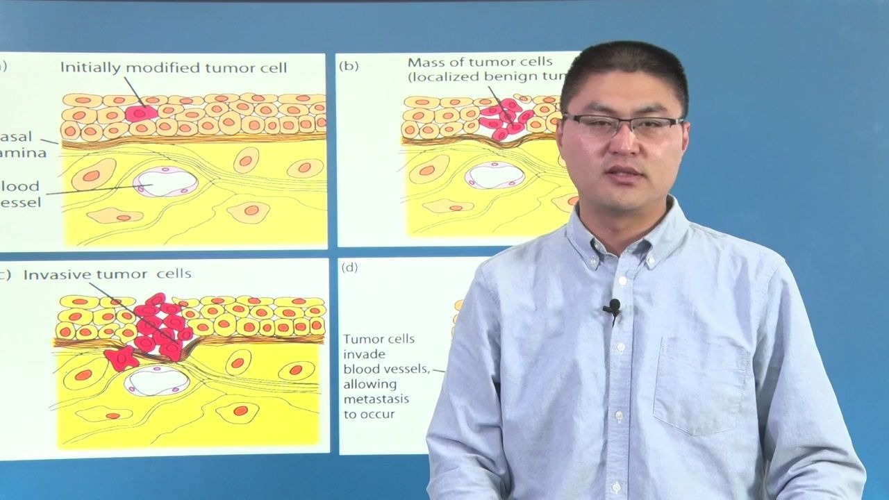 2018版《医学免疫学》第十七章《肿瘤免疫》哔哩哔哩bilibili