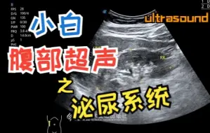 下载视频: 超声小白教程-腹部超声扫查（泌尿系统）