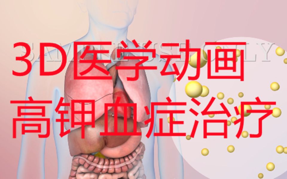 高钾血症治疗方案3D医学动画哔哩哔哩bilibili