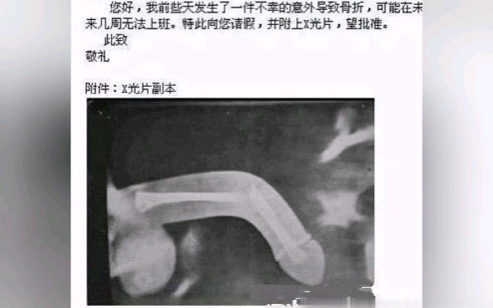 [沙雕图]你见过最奇葩的请假理由是什么?网络上那些爆笑请假图片!哔哩哔哩bilibili