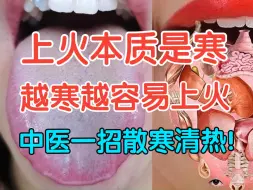 Download Video: 上火的本质是寒，越寒越容易上火，中医一招散寒清热！