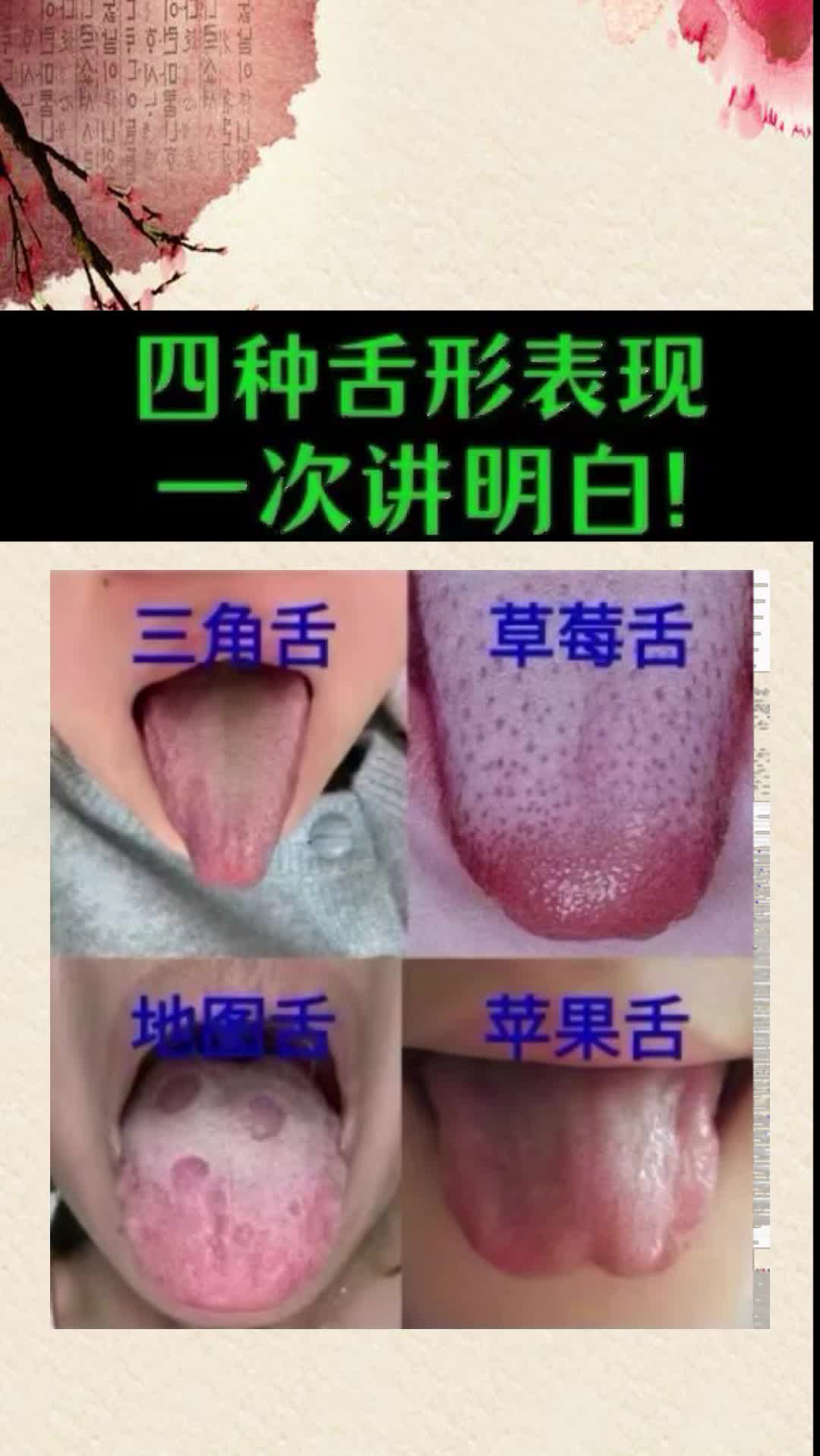 四种舌形表现,一次性说明白#健康##中医##舌象