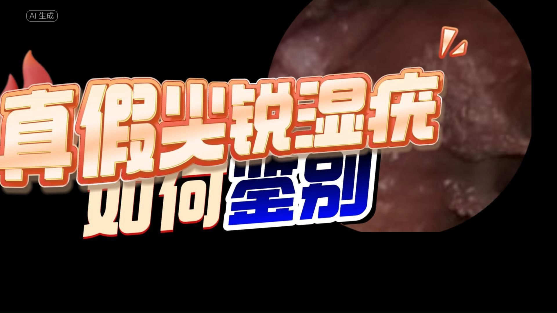 【尖锐湿疣诊断与治疗】第27集 | 真假尖锐湿疣如何鉴别?
