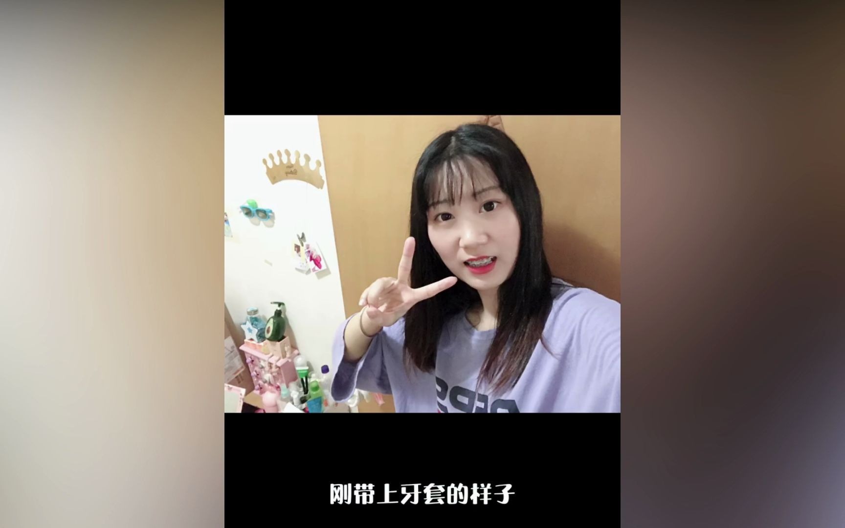 东莞牙齿矫正记录变化哔哩哔哩bilibili