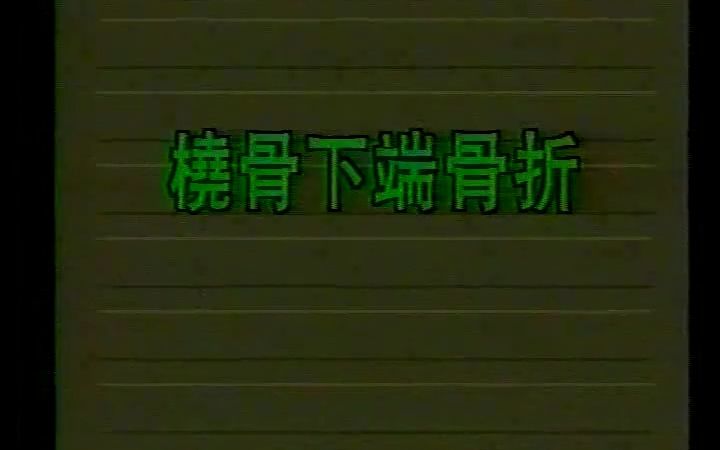 桡骨远端骨折,剪辑自1994年《中国骨伤学》,添加字幕供中医骨伤爱好者学习哔哩哔哩bilibili