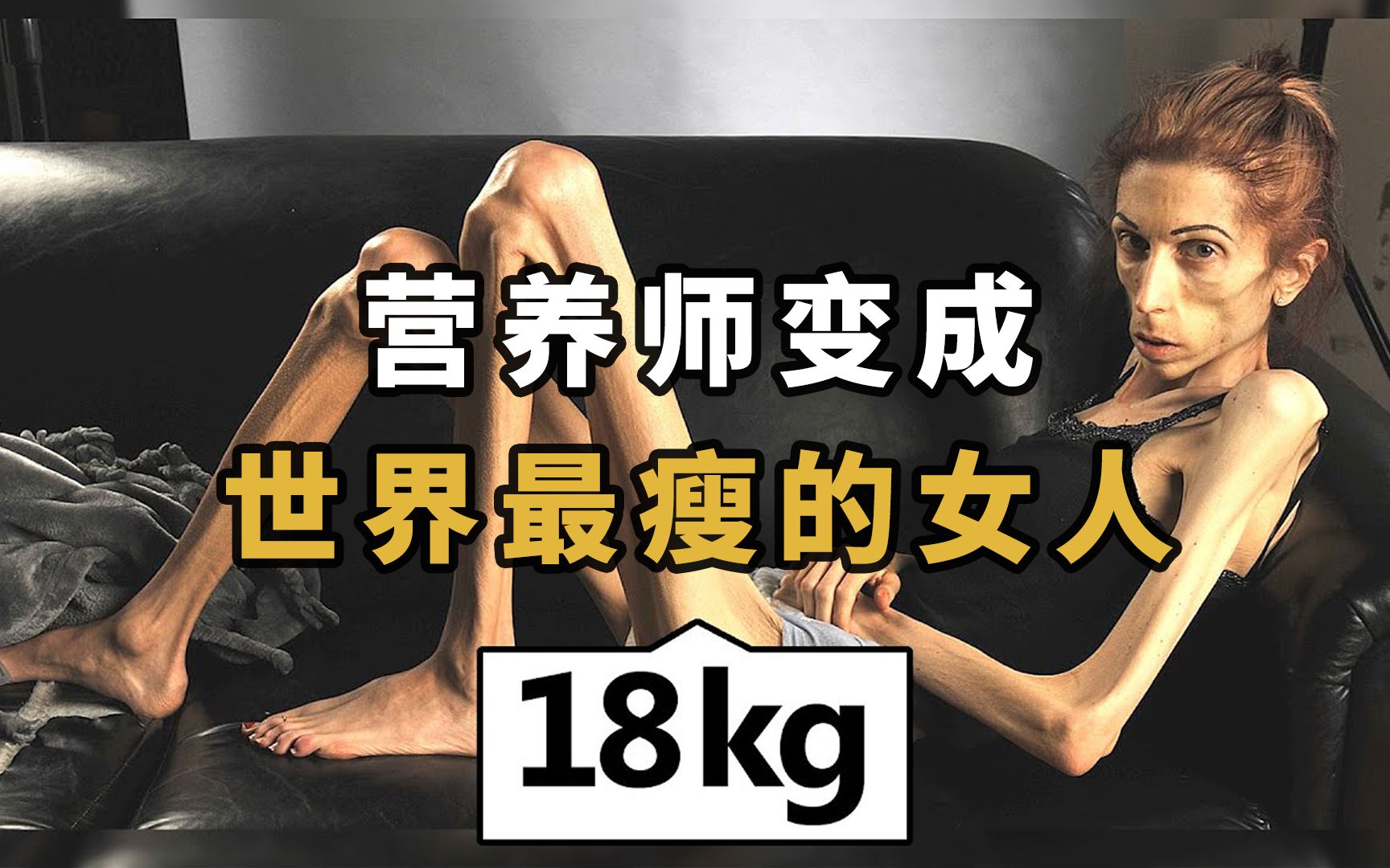 世界上最瘦的女人,体重只有18公斤的营养专家