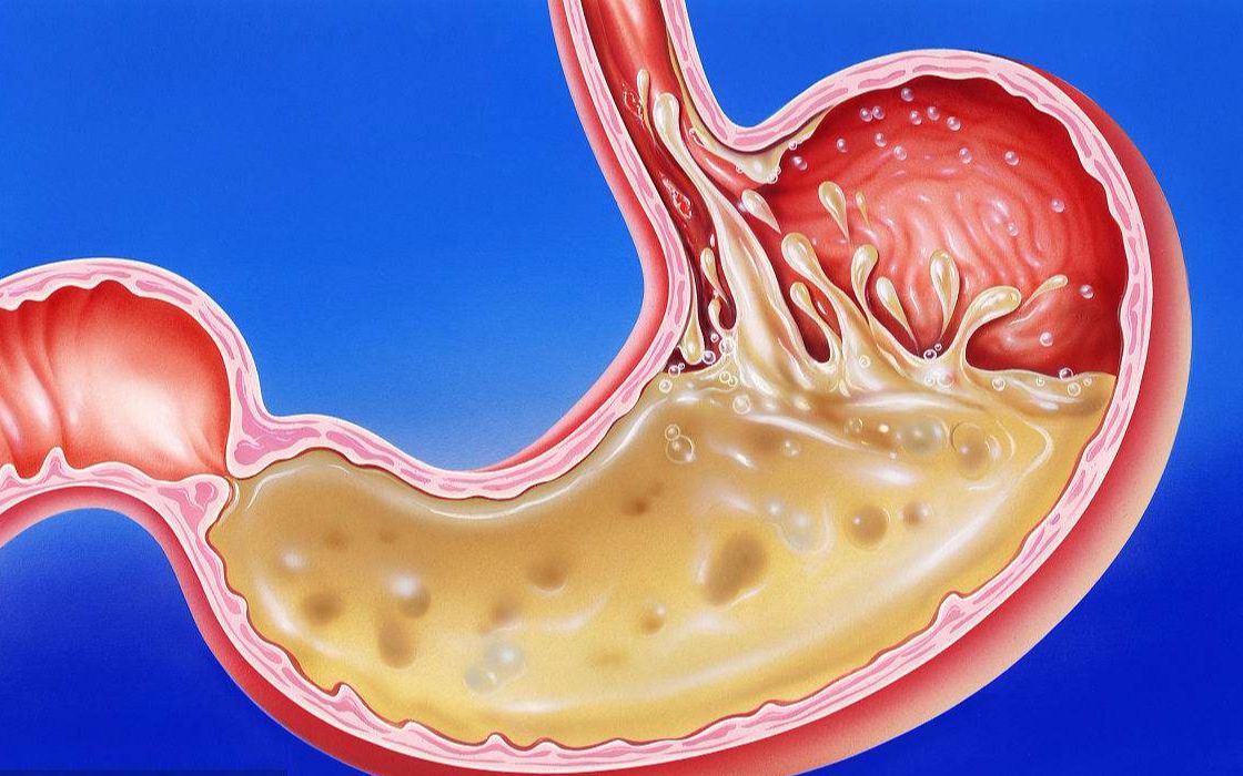 【2049日报】s03e200 胃液为何不能消化胃