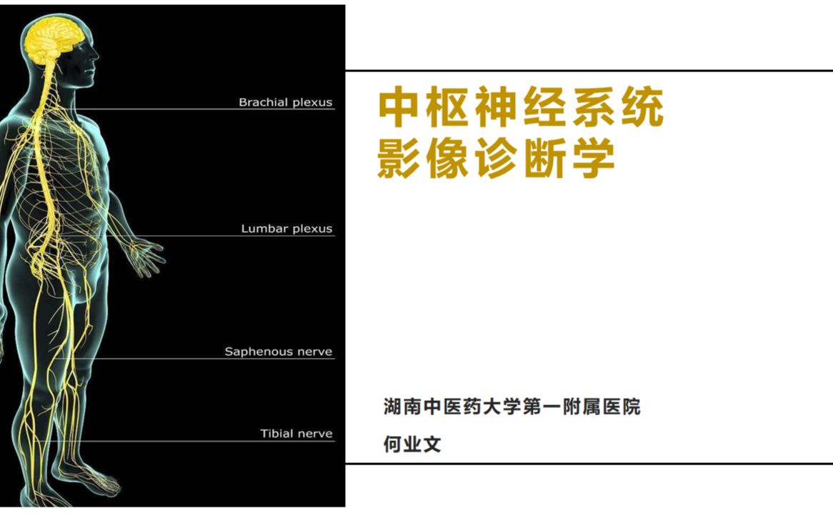 [图]HNUCM《影像诊断学》录课---中枢神经系统影像诊断