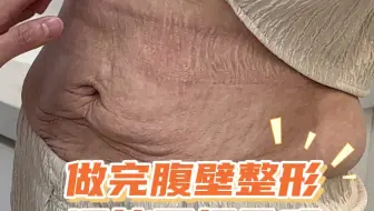 做完腹壁成形还能再怀孕吗？