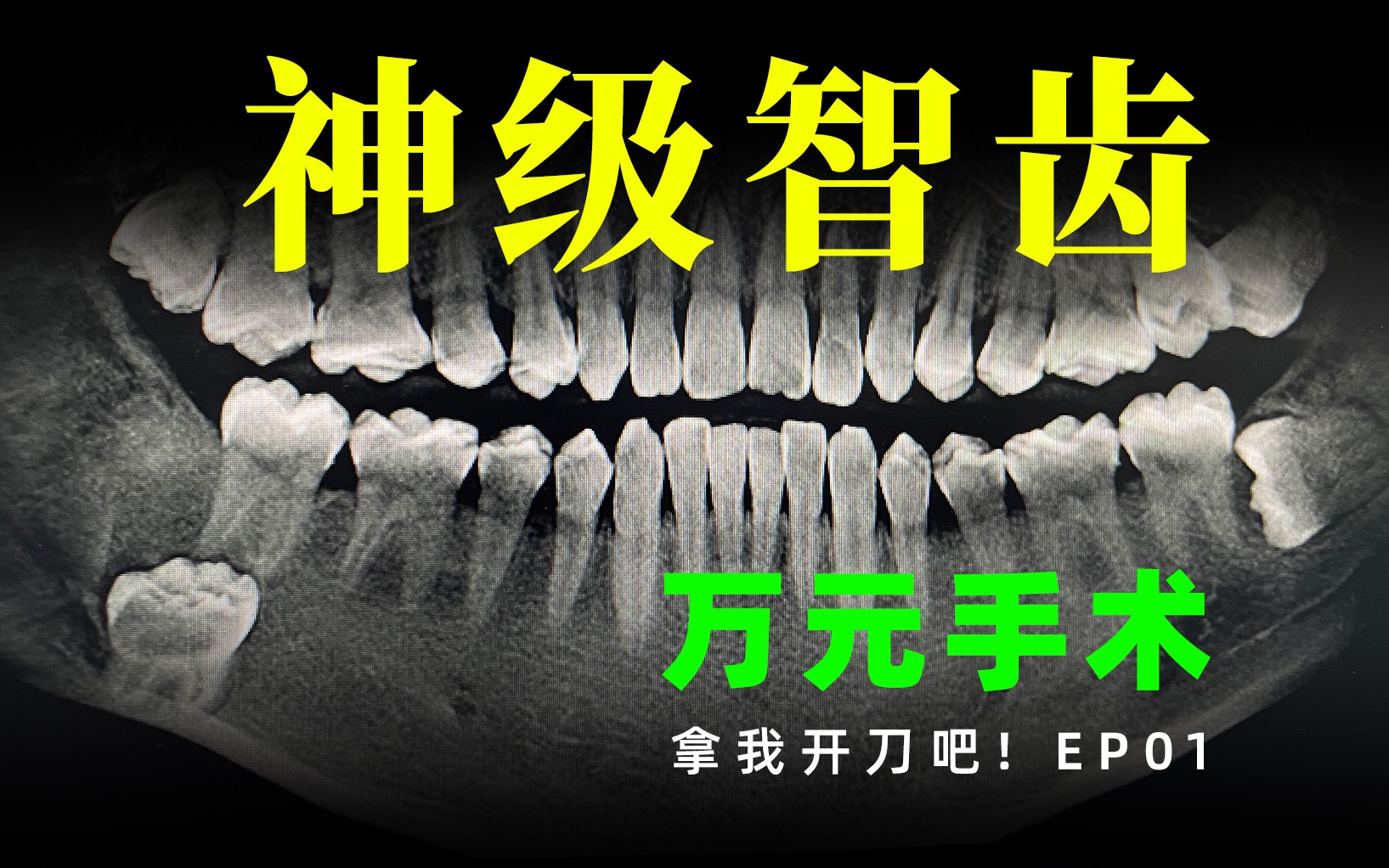 神级智齿 全麻手术 万元账单 我真的后悔了！ 【拿我开刀吧】第一集