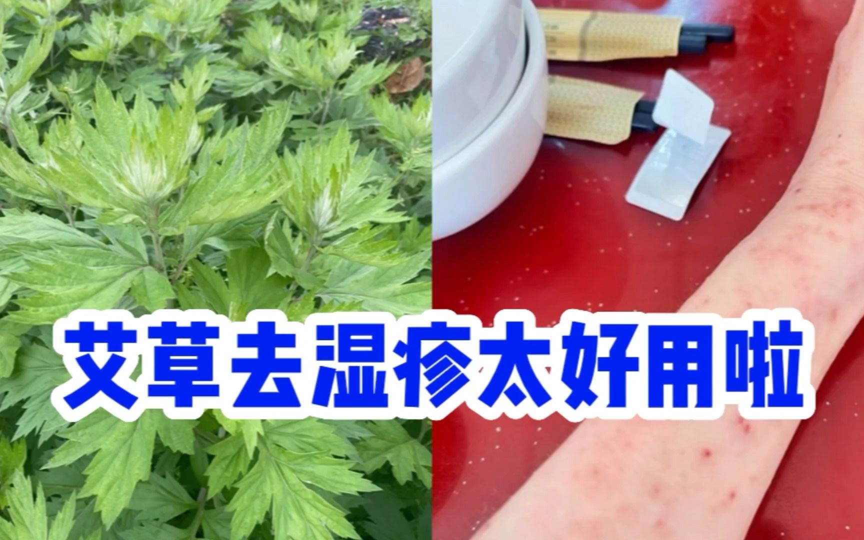 艾草祛溼疹太好用了,一招頑固溼疹都斷根.我都服了