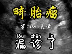 Video herunterladen: 10cm大小的畸胎瘤竟然漏诊了......