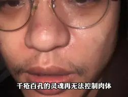 Download Video: 千疮百孔的灵魂再也无法控制肉体 只留下一具空洞无神的躯壳