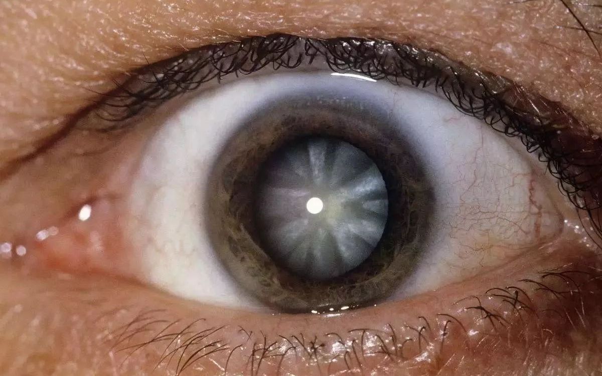 打完这游戏,我散光更严重了!