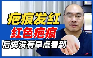 Download Video: 疤痕发红、红色疤痕怎么办？看这篇就对了！