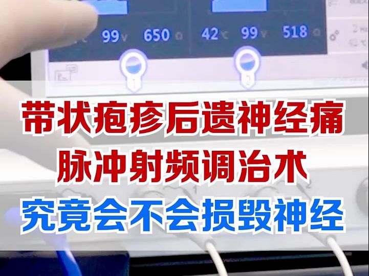 带状疱疹后遗神经痛,脉冲射频调治术究竟会不会毁损神经哔哩哔哩bilibili