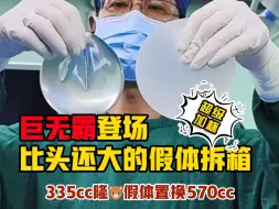 Tải video: 女孩子选择置换570cc假体，背后的秘密竟然是？