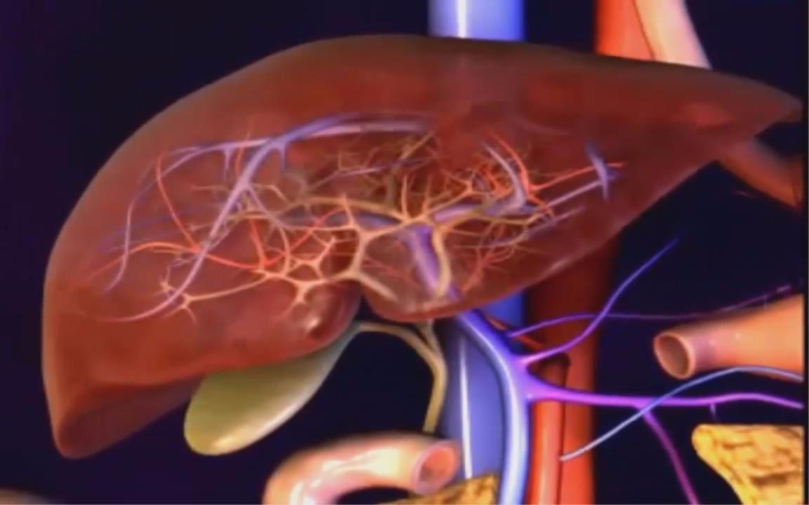【肝硬化】全面认识肝硬化,肝脏功能、肝硬化原因、症状(乐喷网字幕)哔哩哔哩bilibili