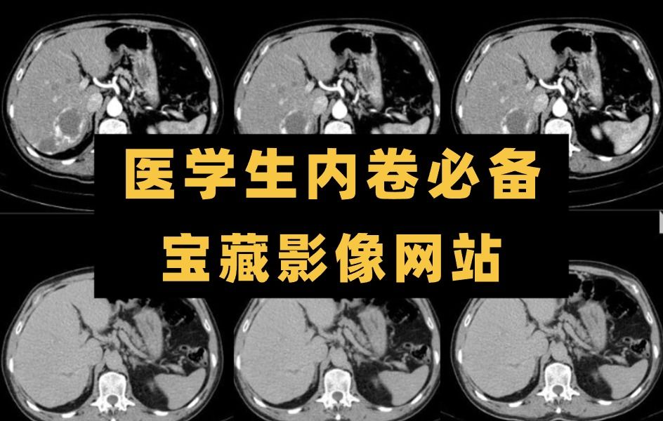 医学生不能错过的宝藏影像网站,真的超级无敌好用!哔哩哔哩bilibili