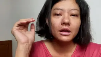 看涨水8斤的小仙浮肿脸，相当于3天没尿尿，以后再也不会肿成这样了！