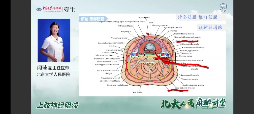 北大教神经阻滞臂丛神经阻滞哔哩哔哩bilibili