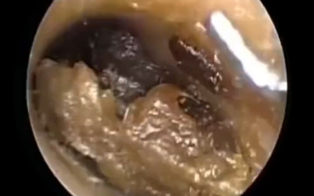 这个视频给你答案!给你解压,放松解压!