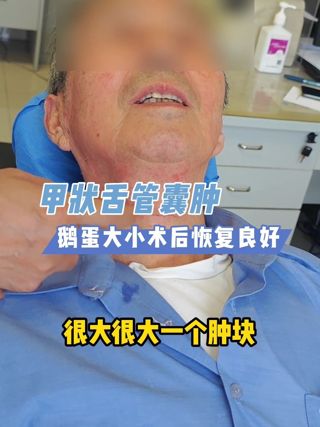 甲状舌管囊肿术后图片图片