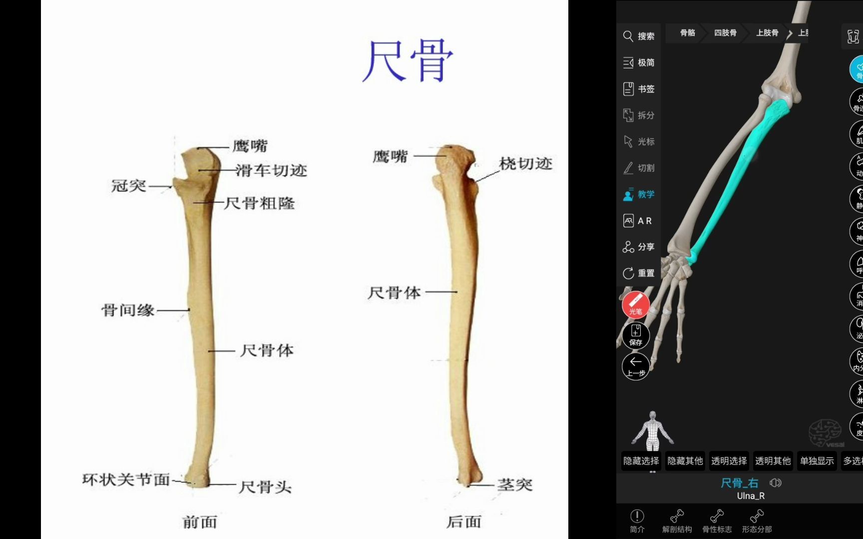 [图]运动解剖基础课 运动系统（1）自由上肢骨 前臂骨 尺骨 桡骨