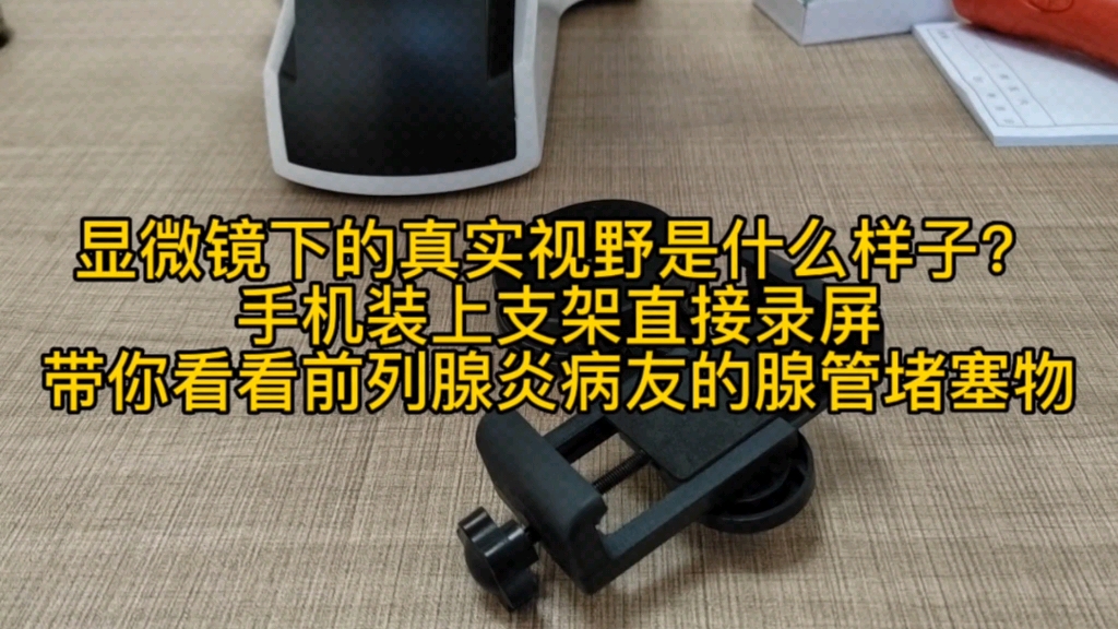 显微镜下的真实视野是什么样子?手机装上支架直接录屏,带你看看前列腺炎病友的腺管堵塞物.哔哩哔哩bilibili