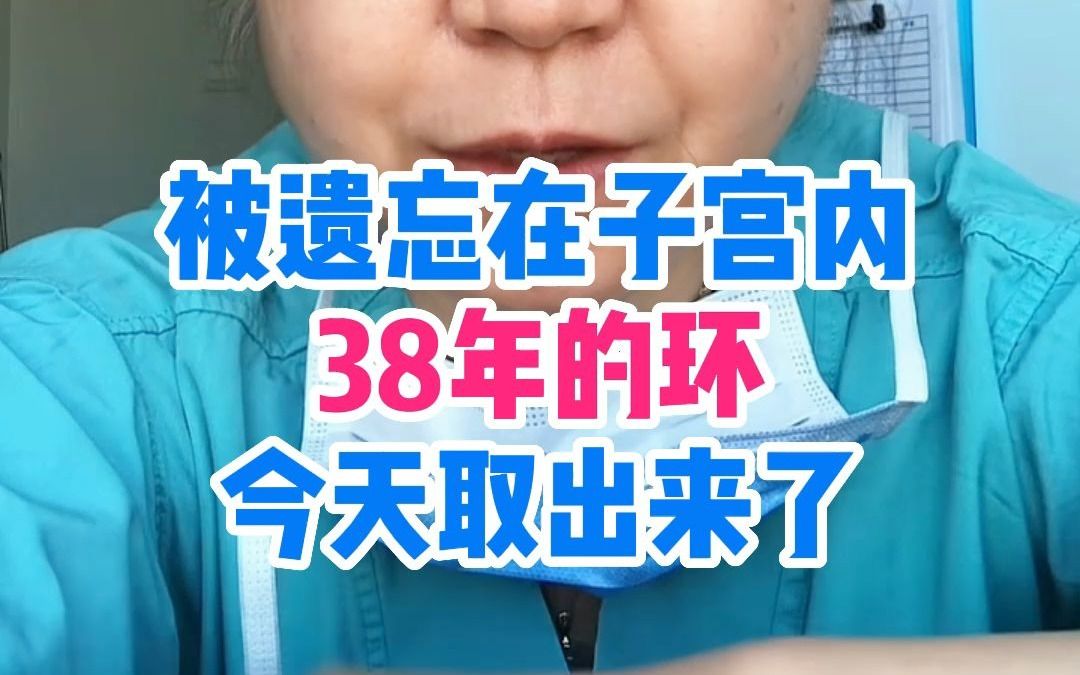 被遗忘在子宫内38年的环今天取出来了哔哩哔哩bilibili