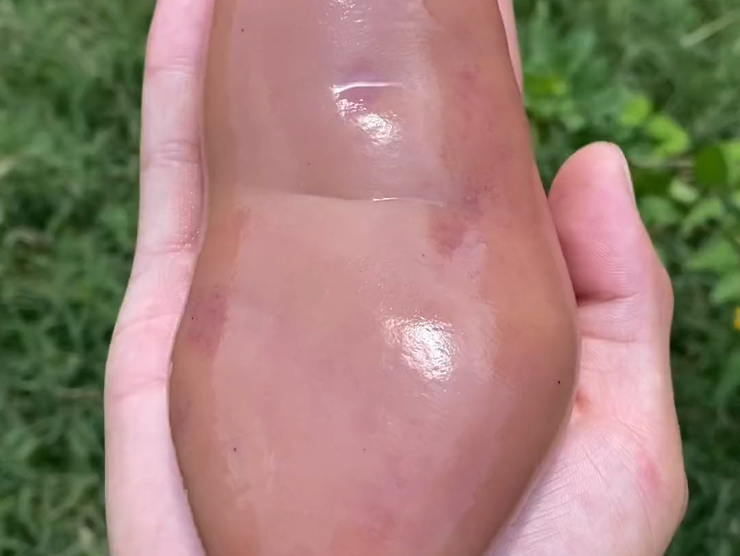 今天我变成了一个大腰子