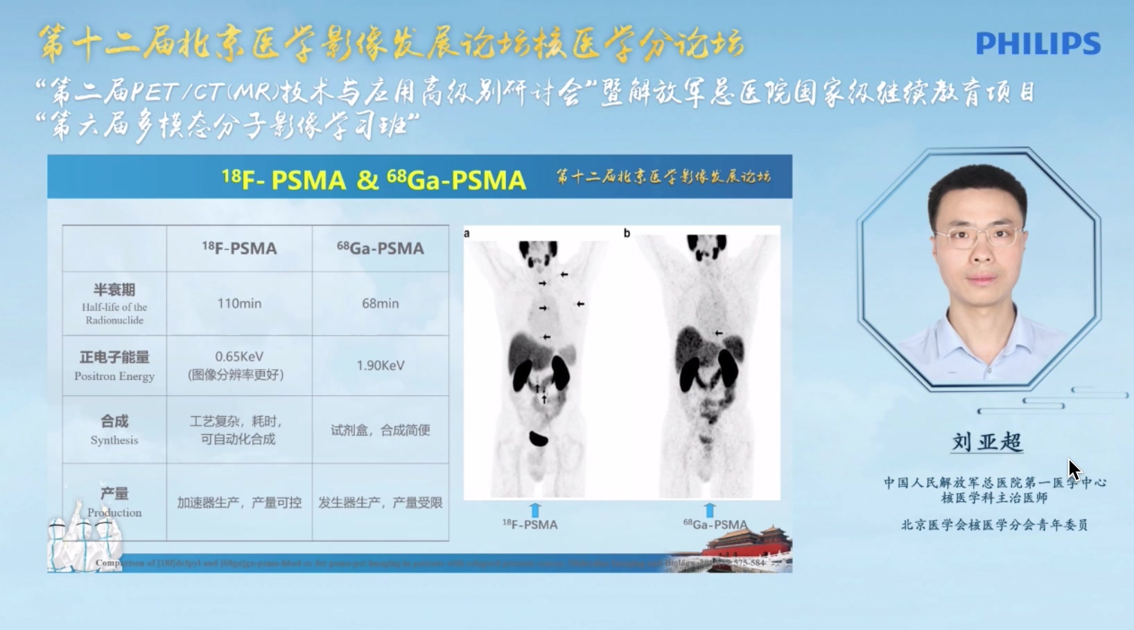 PSMA应用经验哔哩哔哩bilibili