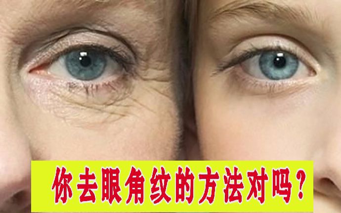 因为眼角皱纹不敢放肆笑?五大招教你恢复紧致双眸!哔哩哔哩bilibili