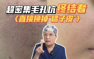 Télécharger la video: 堪比橘子皮？！这次是真的治好了！！！