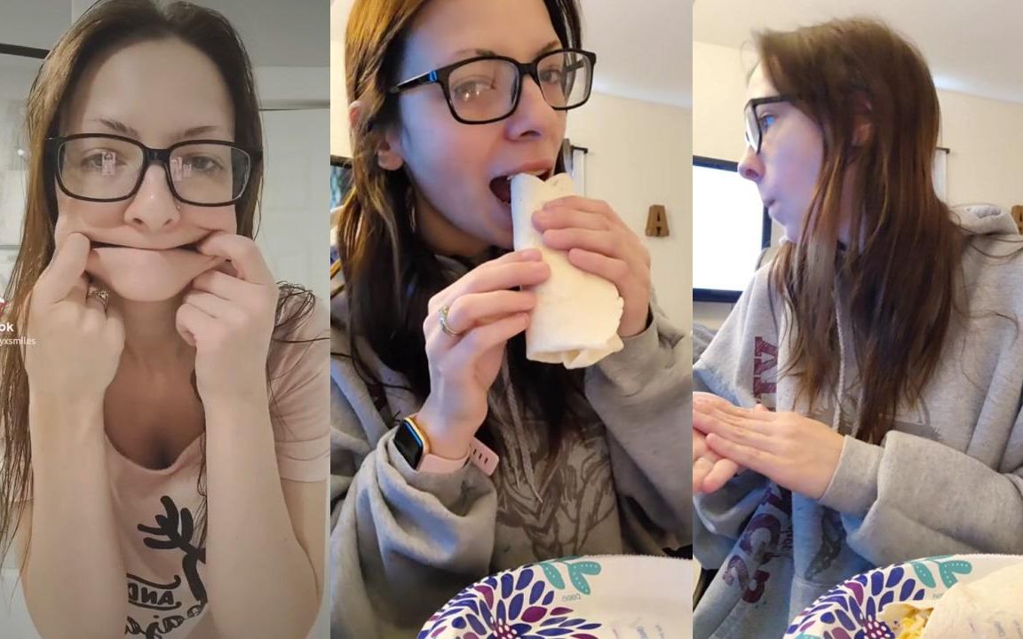 无牙女孩演示用自己的假牙吃饭非烤瓷牙种植牙全瓷牙全口种植