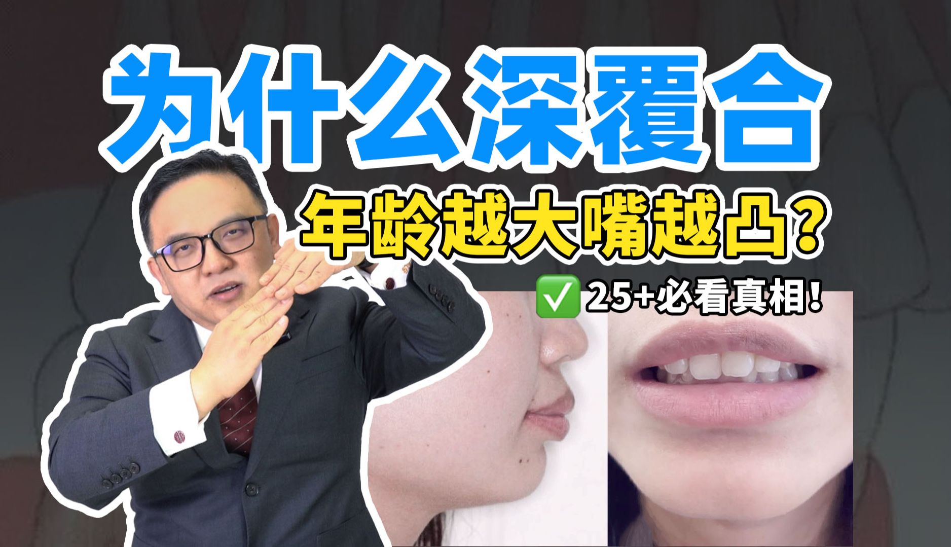 深覆合年龄越大嘴越凸?25+女性必看真相!哔哩哔哩bilibili