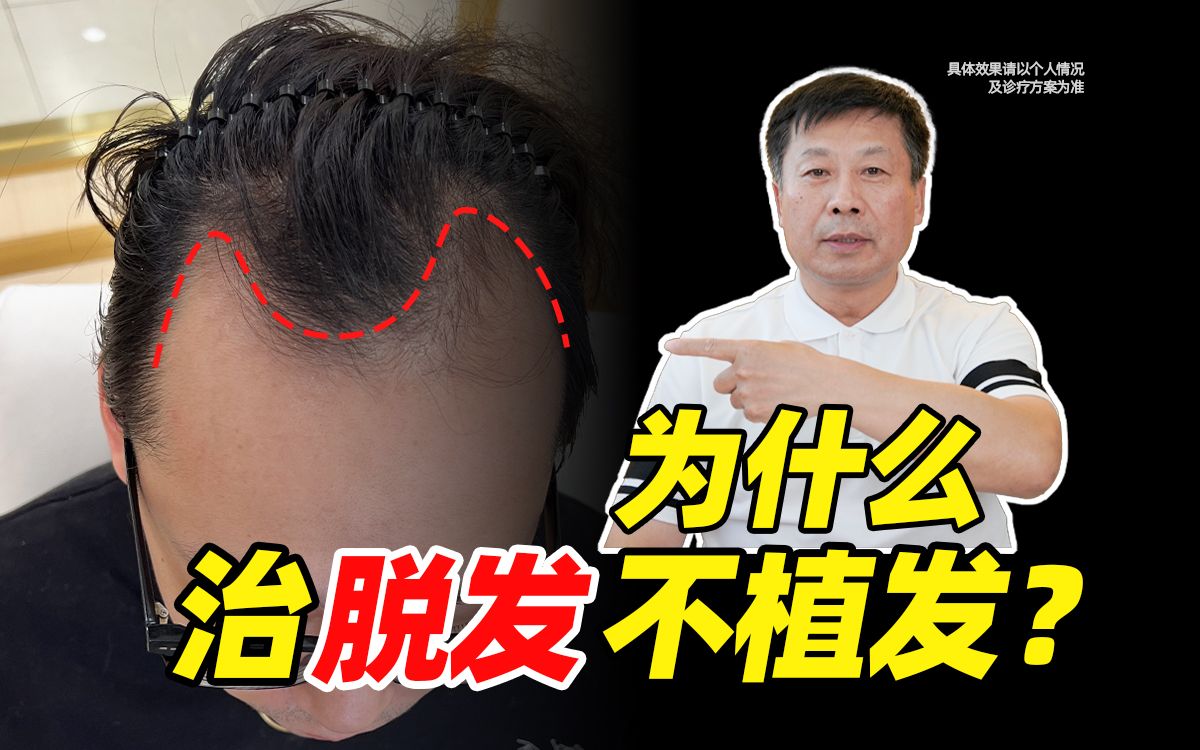植发诗(植发诗能治好白发吗?)