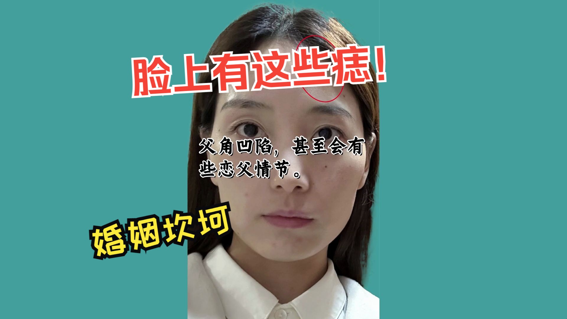 女人脸上有这些痣,小心婚姻不顺,事业受阻!哔哩哔哩bilibili