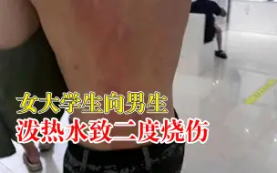 Download Video: 女大学生向男生泼热水致二度烧伤，校方：女生已道歉，双方和解