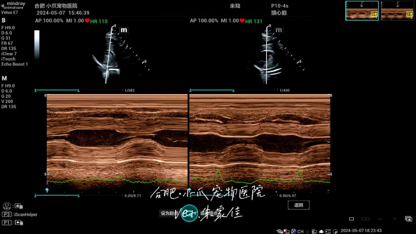 分享今天的喜悦,3月在他院确诊HCM(肥厚型心肌病)C期的猫猫左图:5.1日的左室短轴乳头肌切面M超模式右图:5.7日的左室短轴乳头肌切面M超模式...
