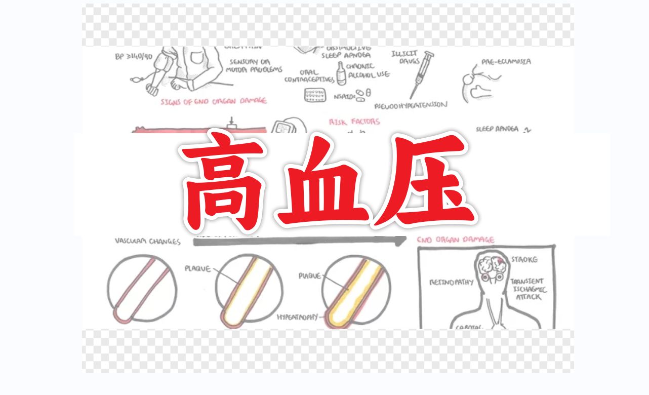 了解高血压【医学科普】哔哩哔哩bilibili