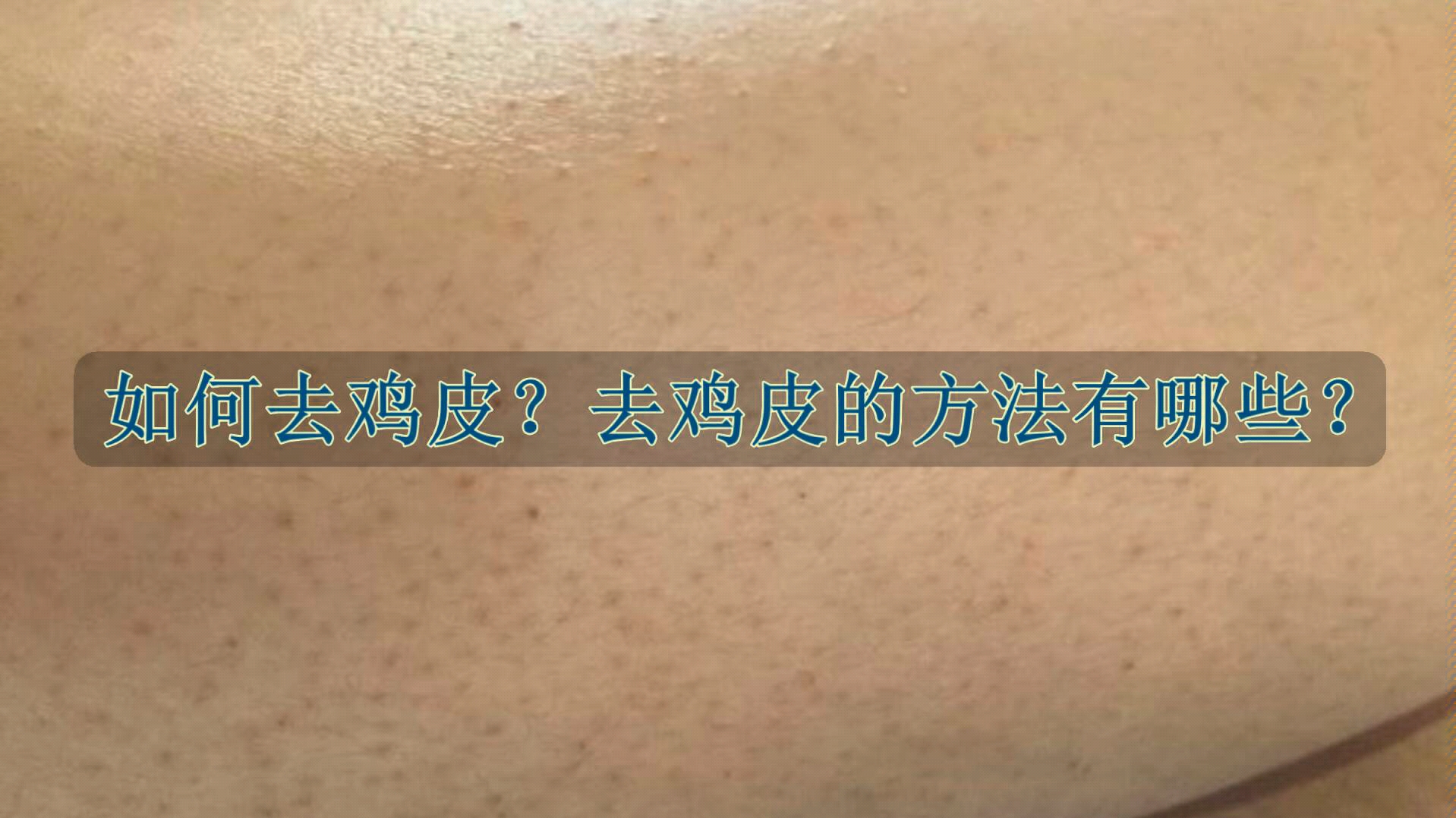 鸡皮肤怎么让毛孔打开呢(鸡皮肤毛孔里可以挤出东西)